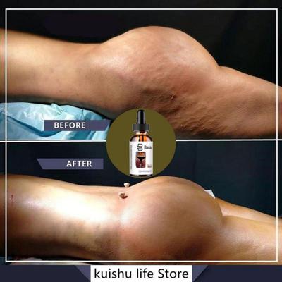 Преобразите свое тело с помощью нашей натуральной формулы для красивой кожи и пышных форм.