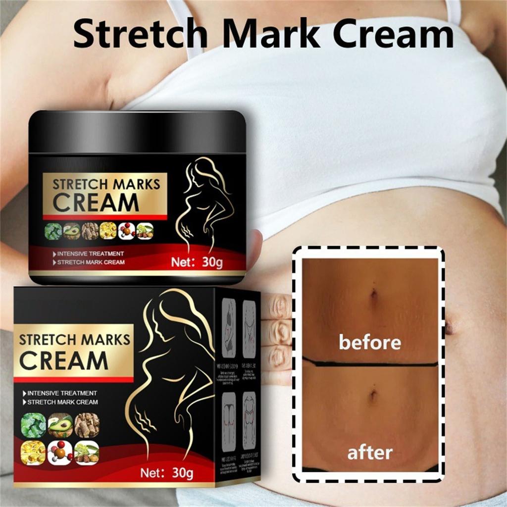 Органический бальзам для кожи и шрамов. Восстановление ран и кесарева сечения. Уход за кожей, шрамы от растяжек при беременности.