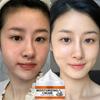 Facial and Body Whitening Cream Removes Dullness, Brightens Skin Tone, Soothes Dryness, and Makes Skin Delicate and Smooth