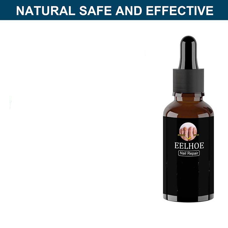 Лечение ногтей Крем для ногтей Уход за ногтями Удаление на пальцах и ногтях на ногах