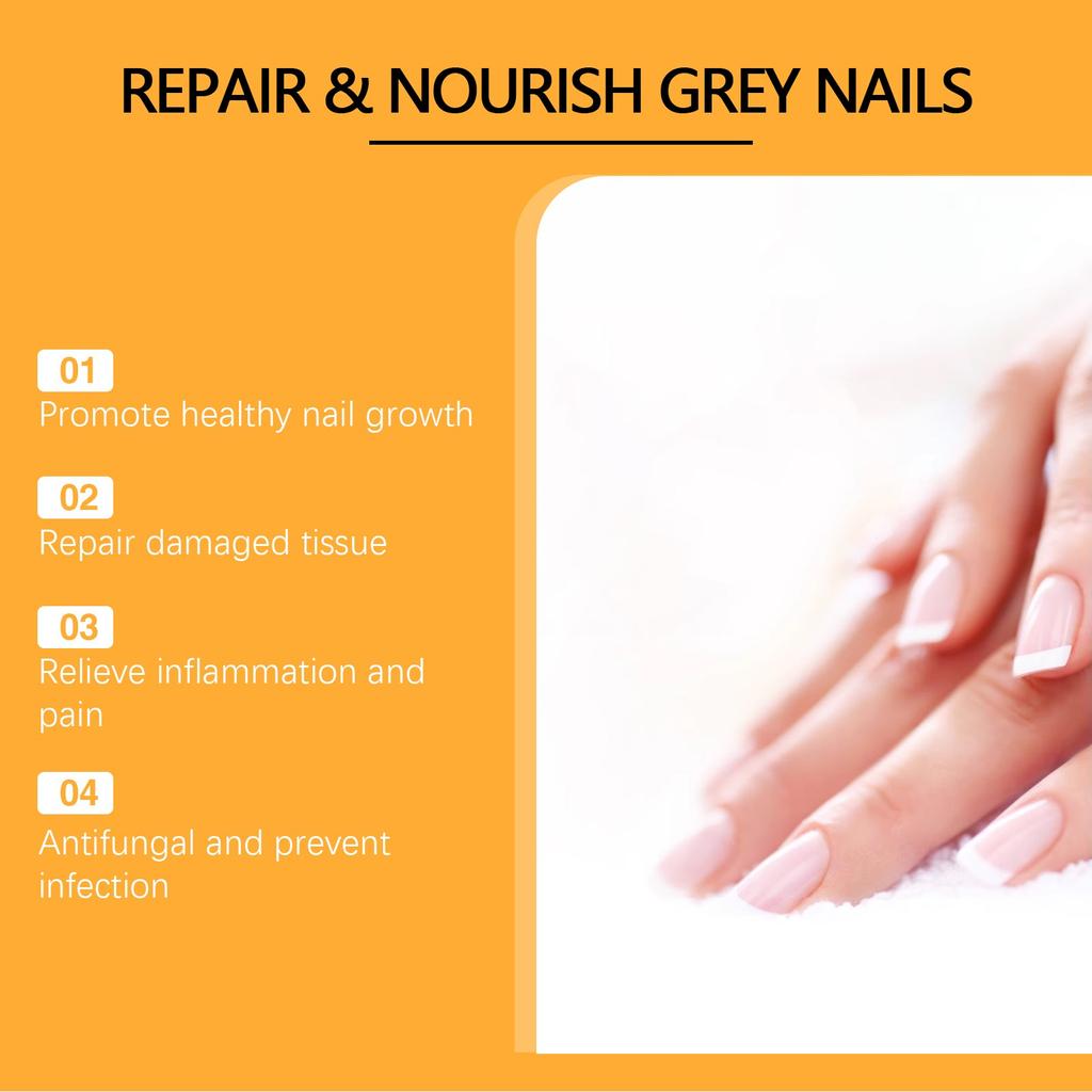 BeeVenom Ash Спрей для ногтей Ash Nail Rotten Nail Увлажняющий чистый спрей для ног 100 мл