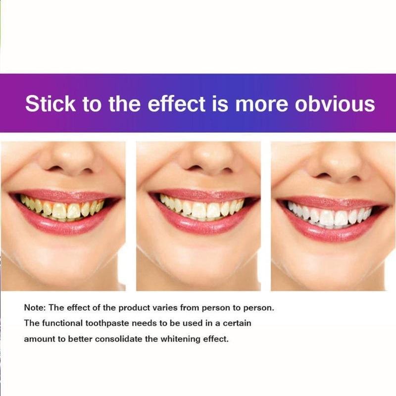 Soda Toothpaste Stain Removal Whitening Toothpaste Fight Bleeding Gum Toothpaste