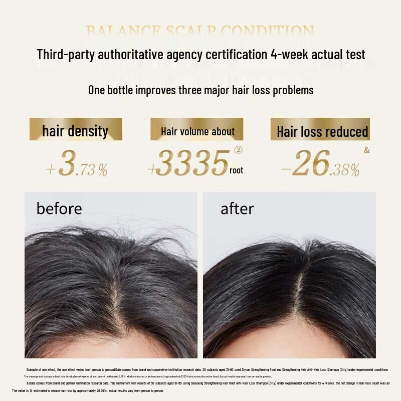 Siyuan Ginger Anti-Hair Loss Shampoo