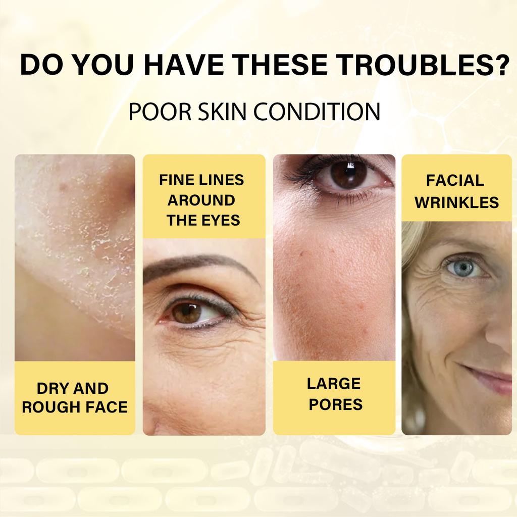 EELHOE Набор нитей с мгновенным лифтингом, коллагеновыми протеинами, наполнителем для лица, рассасывающейся нитью, укрепляющей шелковой фиброиновой линией, антивозрастной эссенцией для лица