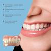 Teeth Whitening Veneers & Gap Covers Kit