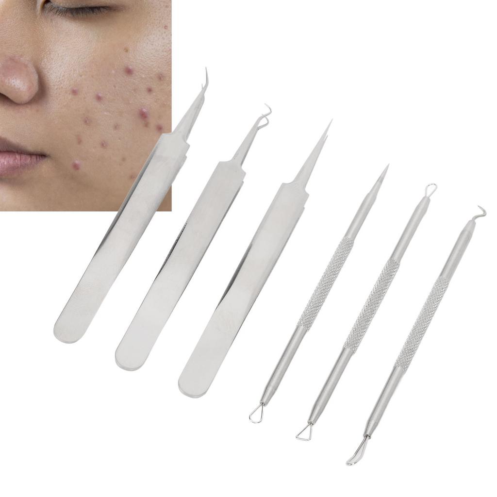 6pcs Blackhead Remover Tool Stainless Steel Pimple Comedones Extractor for Blemish Whitehead Popping