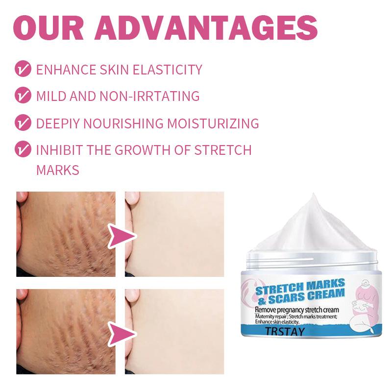 Крем для восстановления растяжек для беременных женщин. Послеродовое восстановление и исчезновение растяжек.