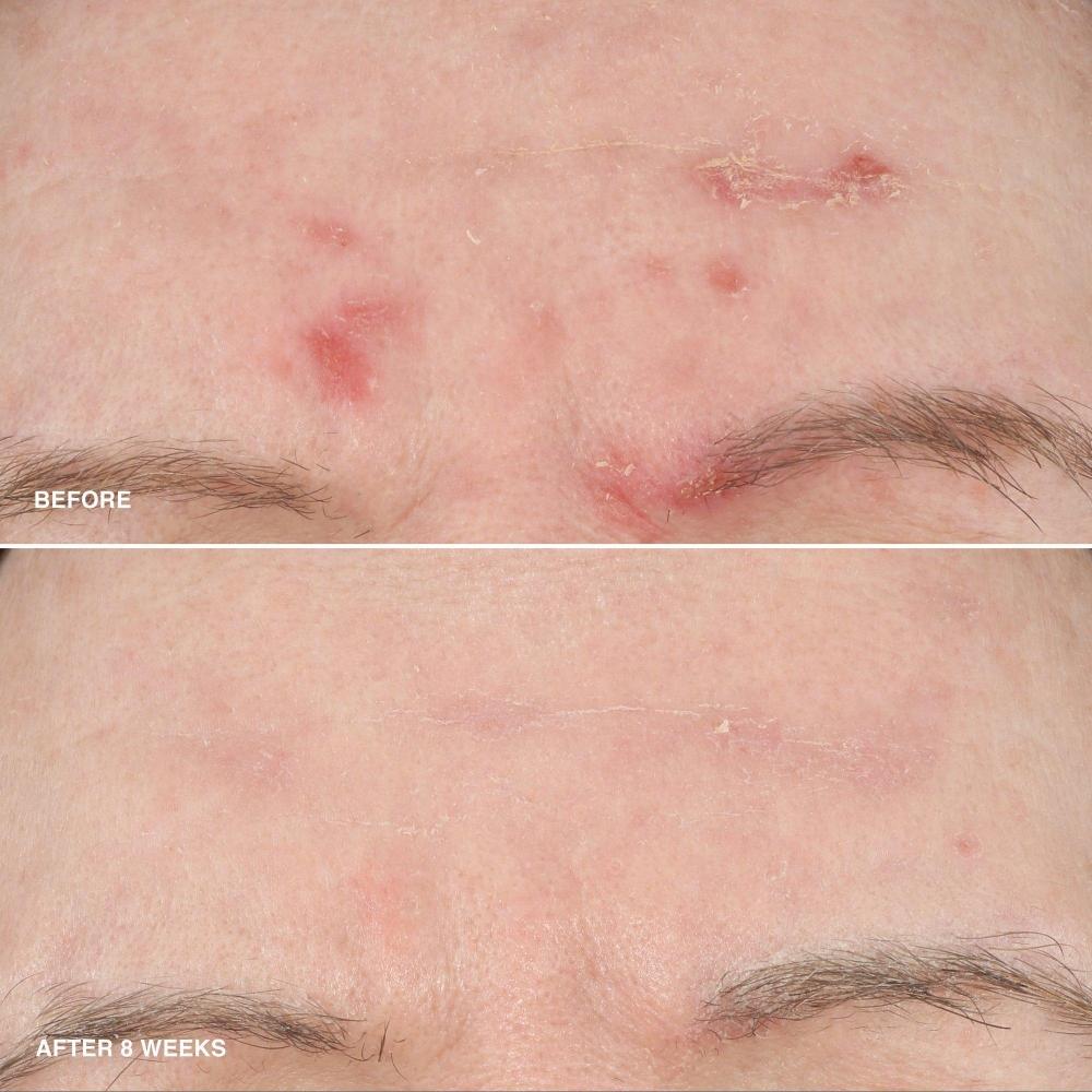 Bobbi Brown Витаминная обогащенная разглаживающая сыворотка с ниацинамидом 1,01 унции