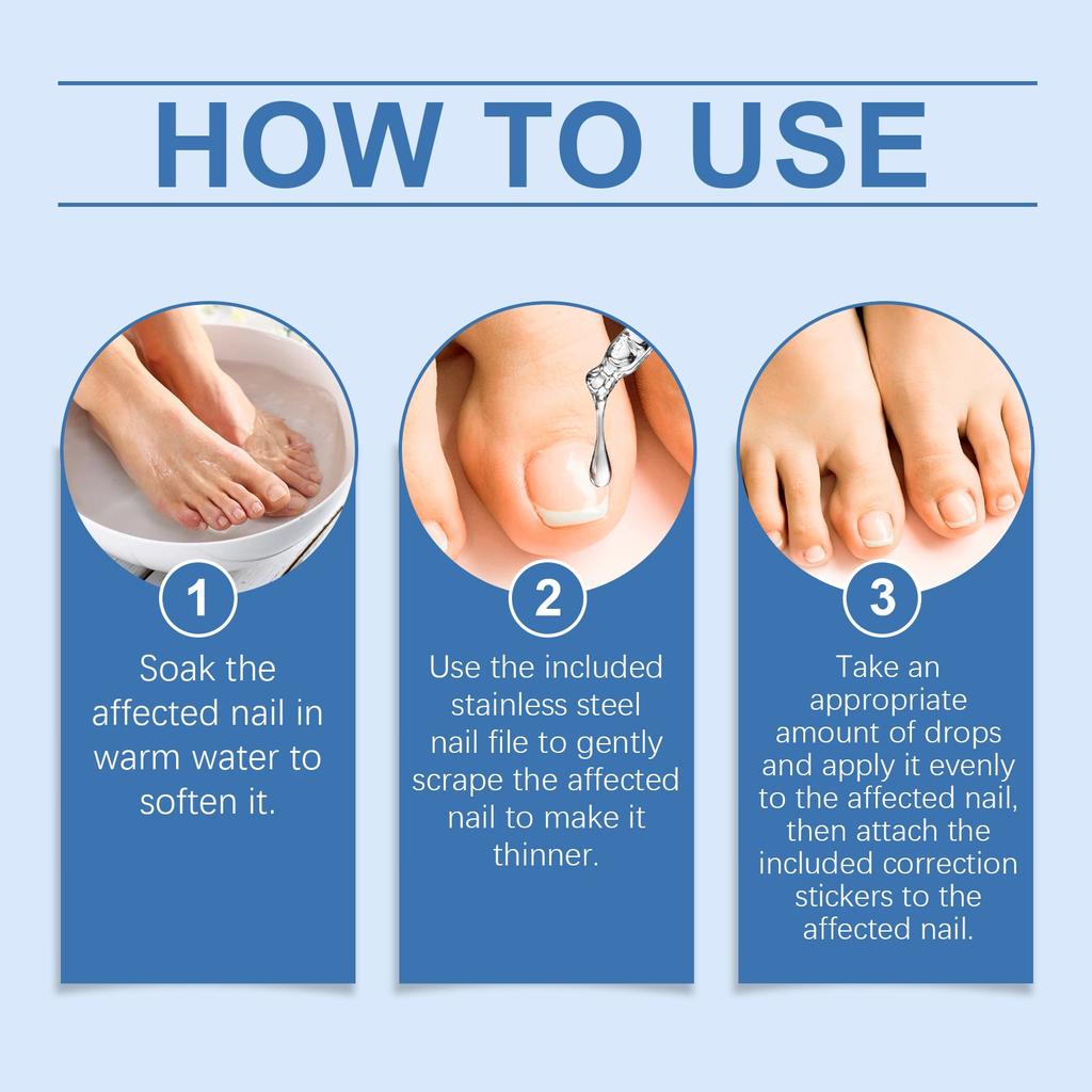 Сыворотка для ухода за ногтями Мягко очищает и осветляет ногти, увлажняет ногти и ногти 30 мл