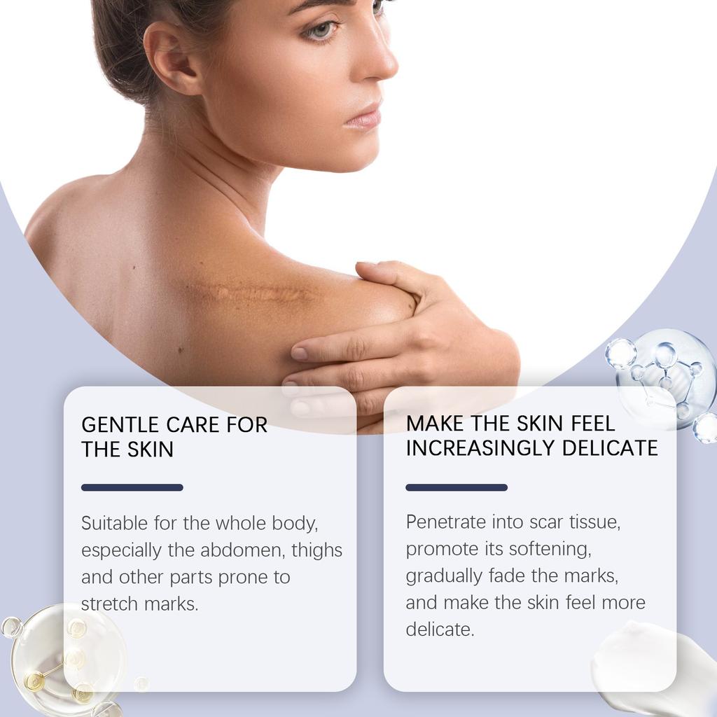 Улучшенный силиконовый гель для кожи, нежное увлажнение и осветление растяжек, осветление тонких линий и удаление геля для разглаживания кожи, 30 г