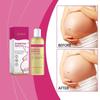 Eelhoe Skincare Oil - Gentle And Nourishing Care For Postpartum Moms, Improves Skin Texture