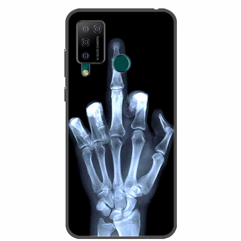 For DOOGEE X96 Pro Case Luxury Silicone TPU Soft Cover Phone Case For DOOGEE X 96 Pro Shockproof Cute Case TPU Bumper Funda Case