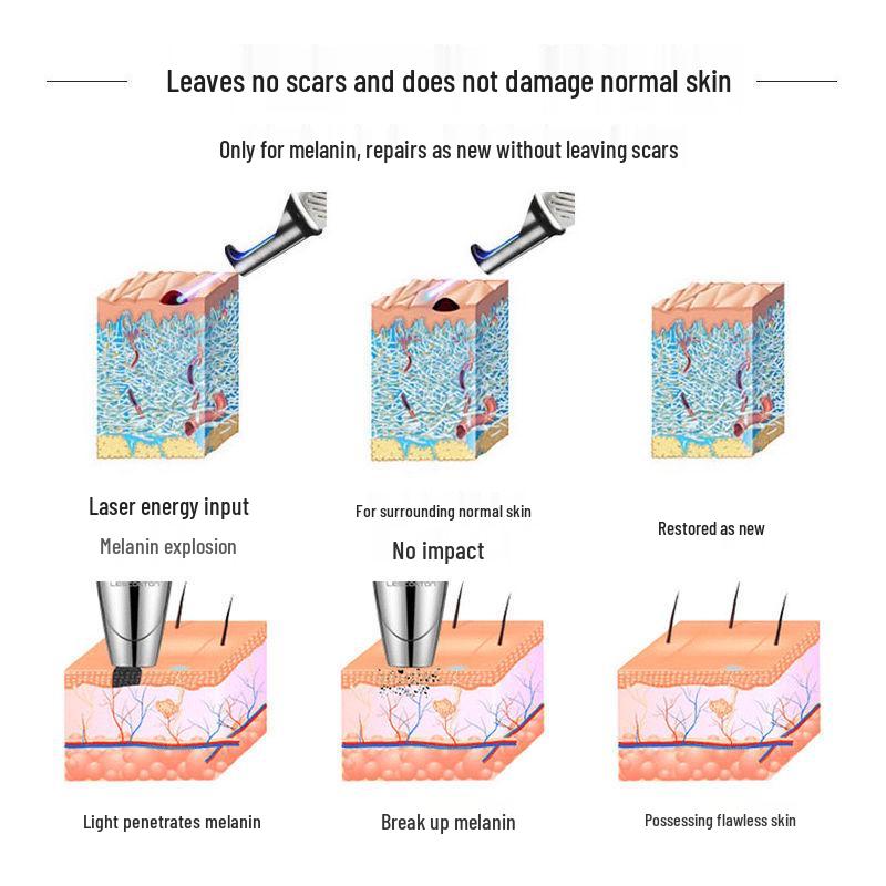 Портативная пикосекундная лазерная ручка для удаления татуировок, веснушек и бровей с красным и синим светом