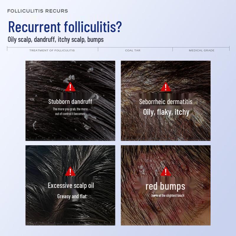 INSDCDOCTOR Шампунь от перхоти и фолликулита с дегтем