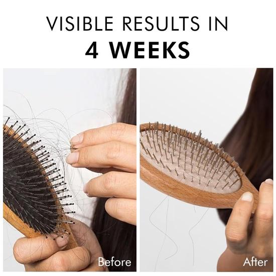 MCaffeine Advanced Hair Fall Control Caffexil® Шампунь с кератином, биотином и розмарином | 80% контроль выпадения волос | Мужчины и женщины | Без сульфатов - 250 мл