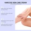Varicose Veins Cream, Varicose Veins And Spider Veins Leg, Improve Blood Circulation, Fast-acting Relief Cream