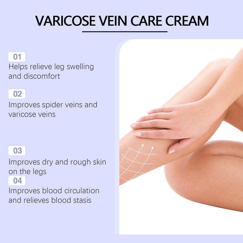Varicose Veins Cream, Varicose Veins And Spider Veins Leg, Improve Blood Circulation, Fast-acting Relief Cream