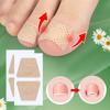 Nail Care Patch Ingrown Toenail Toe Pad Orthopedic Patch Soft Nail Onychomycosis Nail Repair Patch
