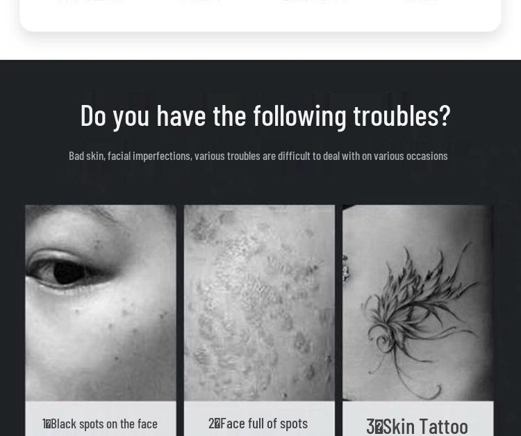 Портативная пикосекундная лазерная ручка для удаления татуировок, веснушек и бровей с красным и синим светом