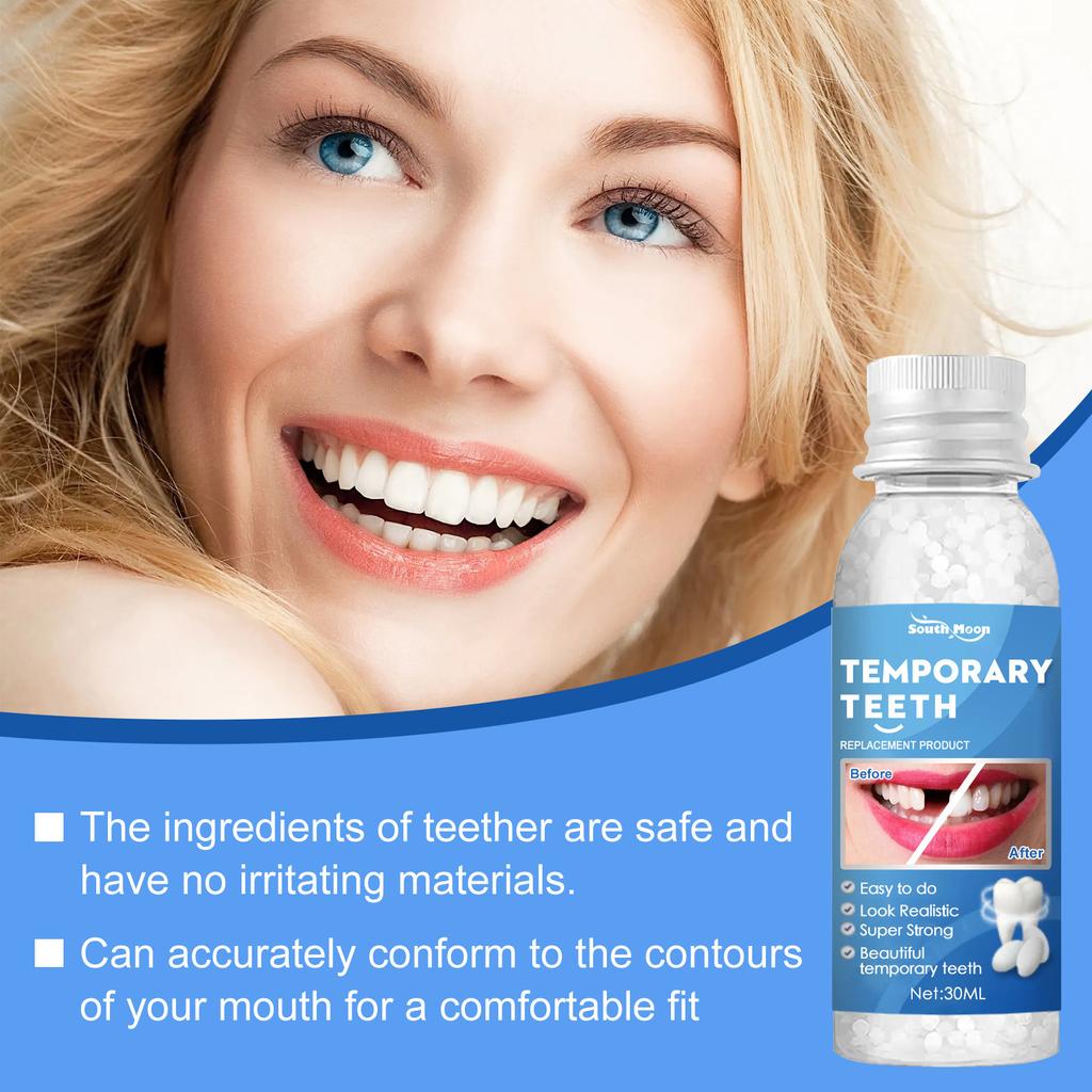South Moon Teeth Repair Putty – Temporary Filling for Chipped Teeth, Gaps & Denture Fix, Easy Mouldable Putty