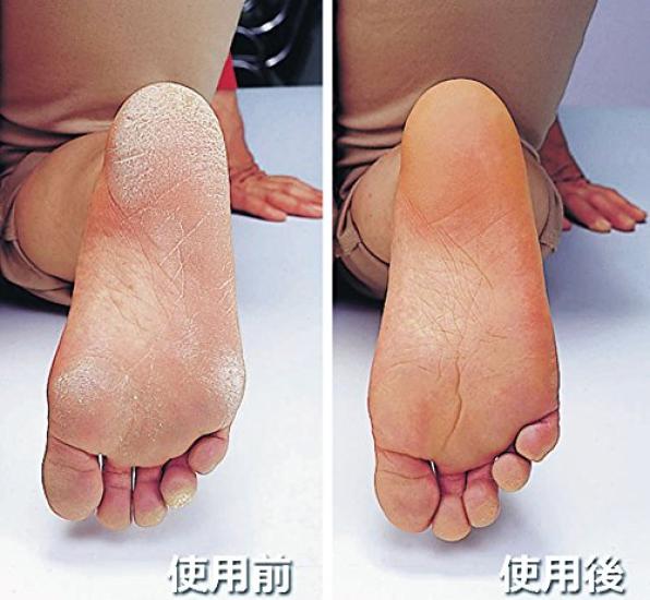 Эстетические носки, Увлажняющие, Двухместные, Серые, 22.0-25.0 см