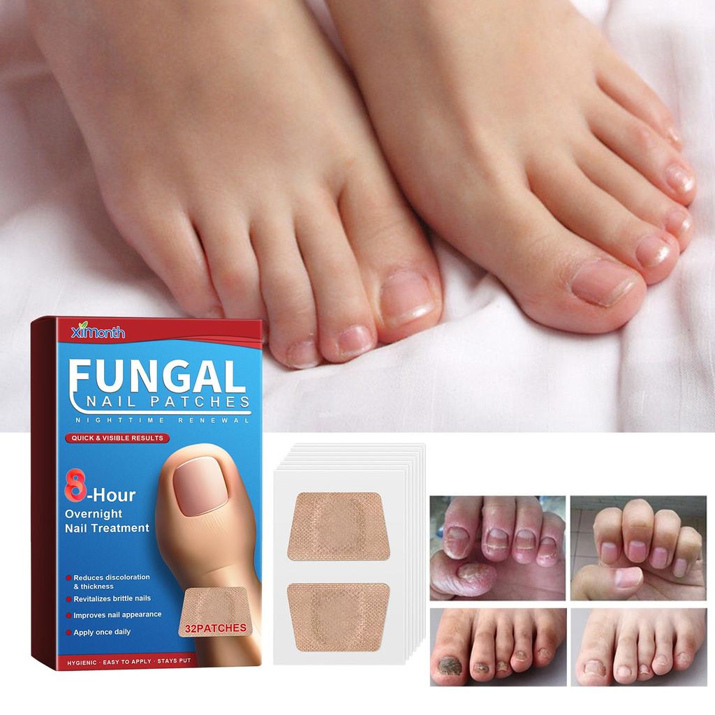 Пластыри для ухода за ночными ногтями Пластыри для ухода за ногтями Пластыри для ухода за утолщенными ногтями Вросшие ногти и мягкие ногти Пластыри для ухода за ногтями