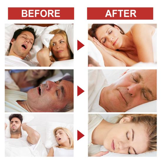 36 шт., полоски для носа, против храпа, для улучшения дыхания, для сна, для облегчения заложенности носа, дышащая нетканая ткань, набор патчей для носа