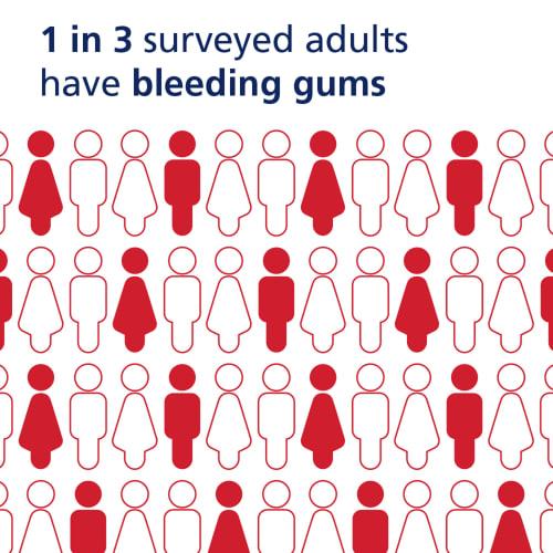 Parodontax Отбеливающая зубная паста для кровоточивости десен, отбеливания зубов и лечения гингивита - 3,4 унции
