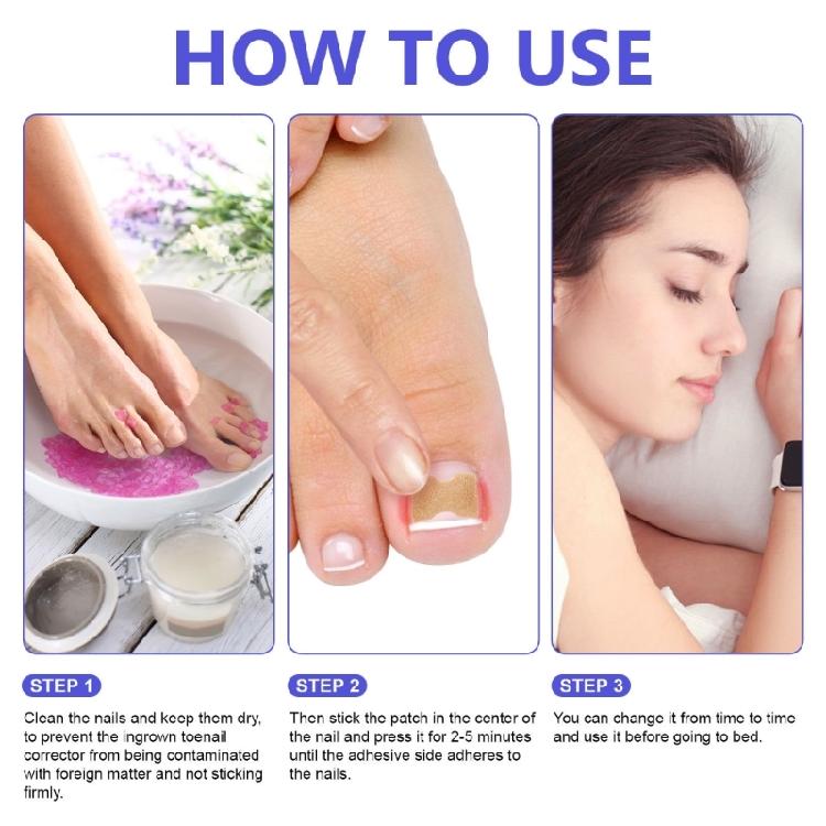 100pcs Paronychia Toenail Corrector Ingrown Patch Foot Care Nail Repair Patch