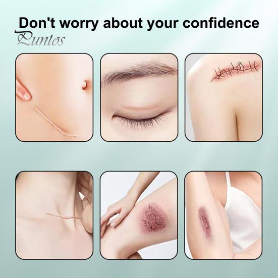 Силиконовые пластыри для рубцов, рулон ленты для рубцов, профессиональные мягкие полоски для рубцов после хирургических операций, келоидные рубцы, лечение угревой сыпи, силиконовый гелевый пластырь