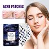 Патчи от акне осветляют закрытые комедоны, очищающие акне, водонепроницаемые, дышащие, восстанавливающие, патчи от акне, узор кожи, патчи от акне