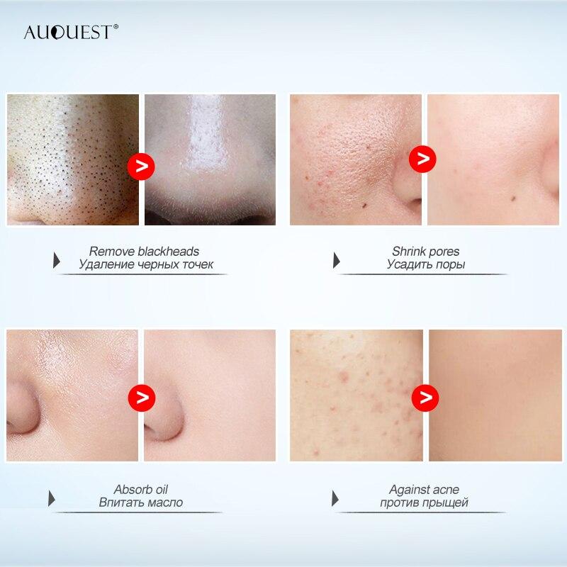 Восстанавливает жирную кожу. Розовая грязевая маска очищает поры от угрей и прыщей. Розовая грязевая маска восстанавливает жирную кожу.