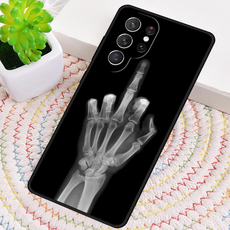 Чехол для телефона из ТПУ с изображением костей руки Рентген для Samsung Galaxy note 10 pro S26 S25 S24 S23 S22 Ultra Plus S21 FE S20 Ударопрочный чехол