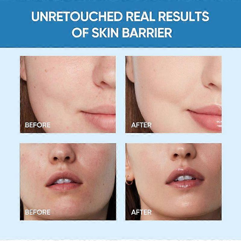 Facial Cream with 5X CeramidesSkin Moisture Barrier Cream Hydrating Face Moisturizer for Dry & Sensitive Skin Barrier Repair with Ceramide, Centella