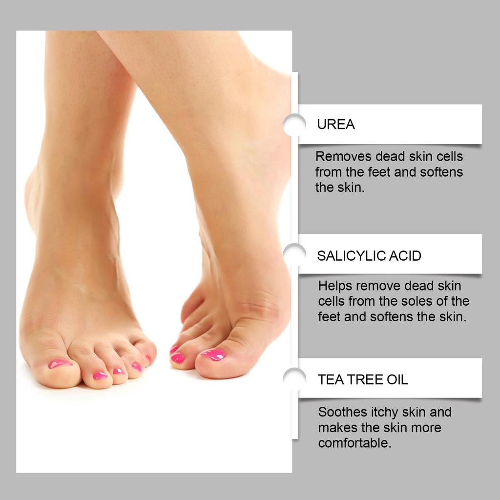 Крем для ног с мочевиной 40%, крем для ухода за потрескавшейся кожей ног и рук, 100 г