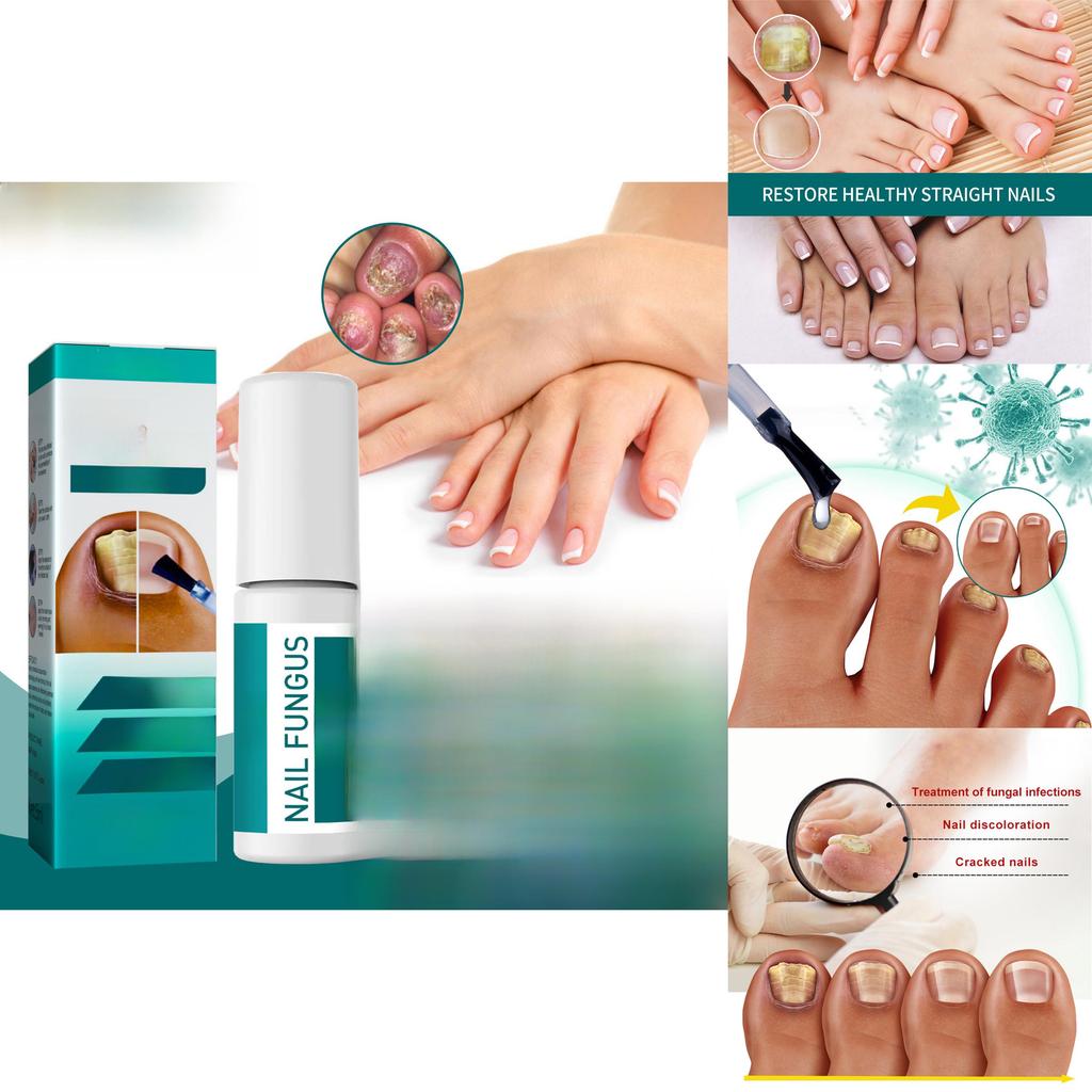 Премиальное средство для восстановления ногтей на ногах 5 мл Для обесцвеченных ногтей и смягчения ногтей