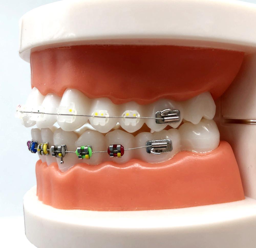 1 шт., стоматологическая модель для ухода за полостью рта, стоматологическая ортодонтическая модель для общения с пациентом, модель для исследования стоматолога