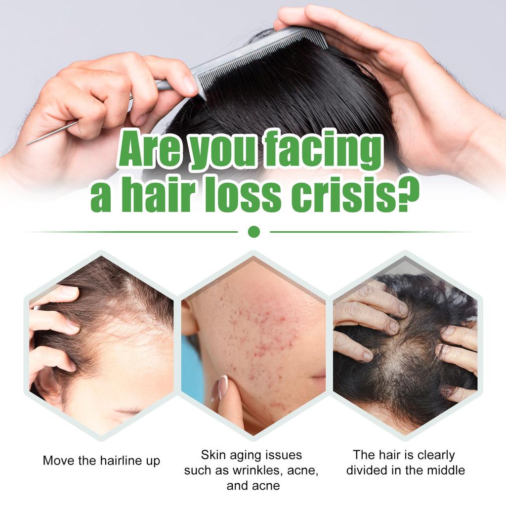 Black Castor Oil Hair Growth Serum, Moisturizing Anti-Hair Loss Strengthening Treatment for Thinning Hair, Nourishing Scalp Oil