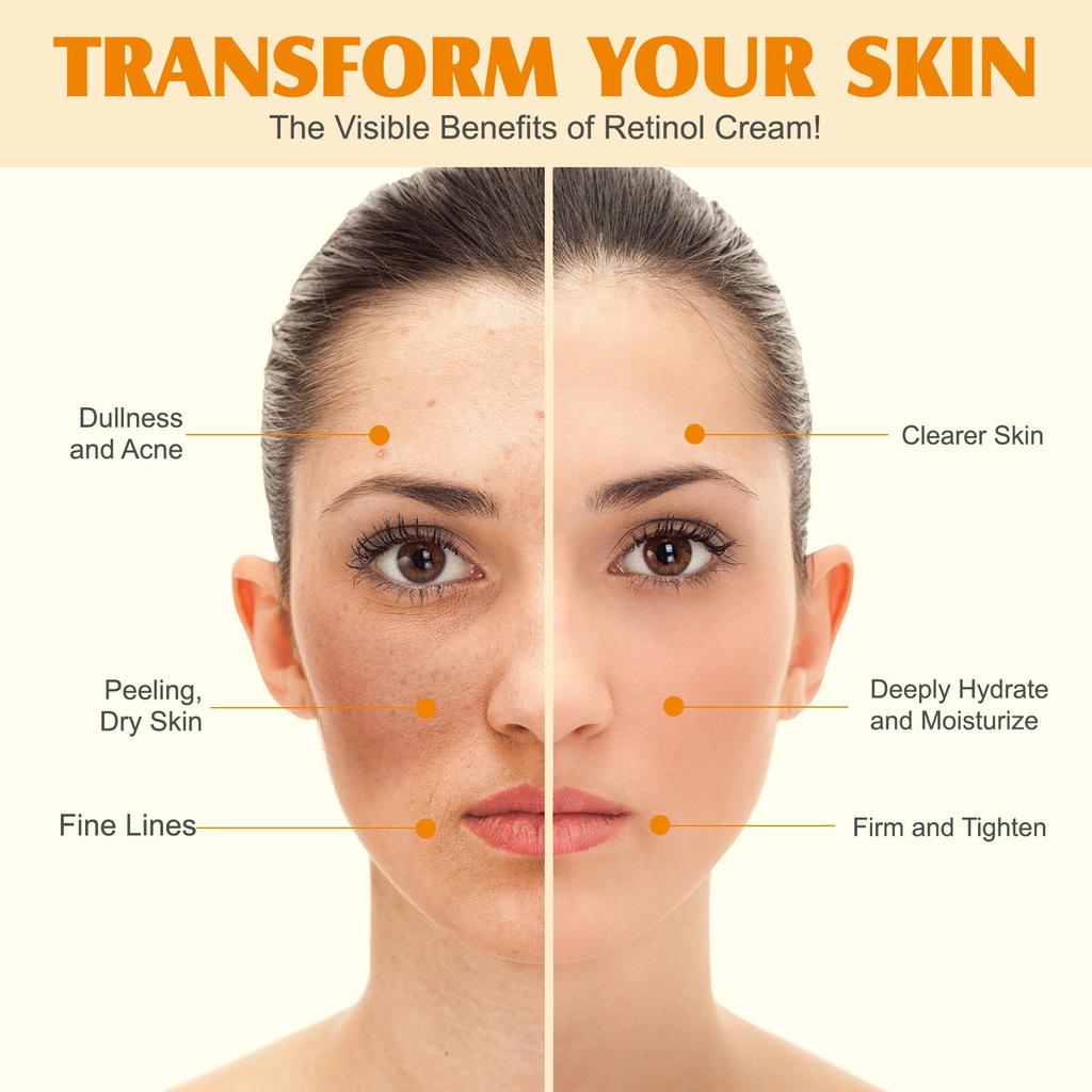 Крем с маслом и медом Увлажняющий, всесторонне увлажняющий, увлажняющий, многоцелевой крем с маслом и медом 60 г