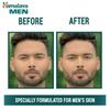 Himalaya Men Pimple Clear Neem Face Wash 50ml Soap Free Acne Control Cleanser for Men’s Skin