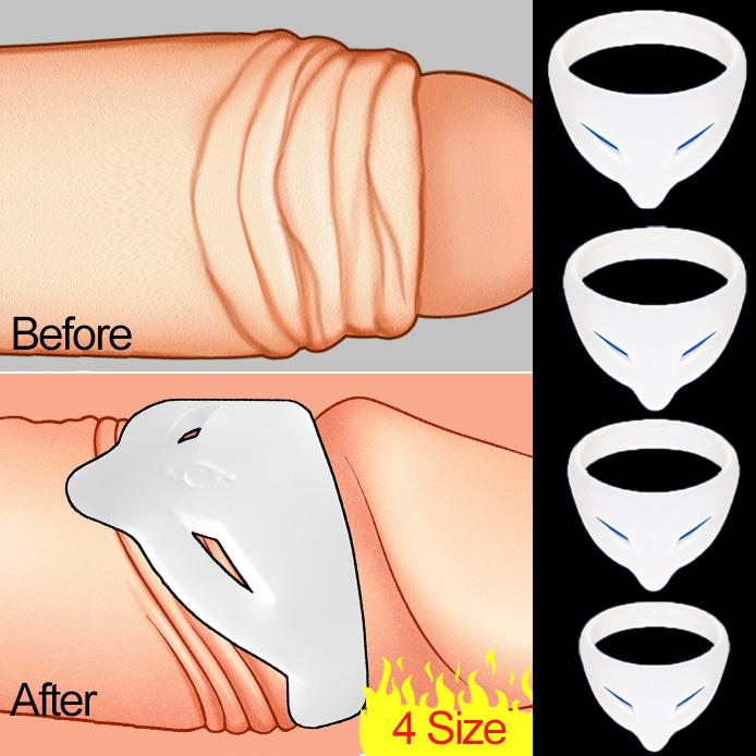 S/L корректор крайней плоти, кольца для пениса, кольцо на член, мужской головной убор, кольца для задержки эякуляции, секс-игрушки для мужчин, игрушки для взрослых