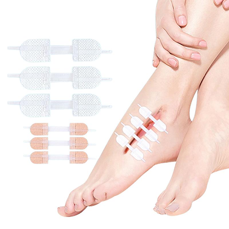 Застежка-молния Заплатка для закрытия раны Гемостатическая заплата для быстрого шва на ране Лента на молнии