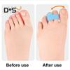 1Pc Overlapping Toe Separator Orthopedic Bunion Valgus Hammertoe Corrector Pain Relief Women Men Foot Alignment Toe Spacer Hammer Toe Straightener