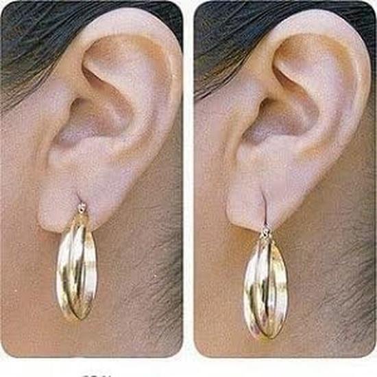Waterproof Earlobe Support Patches Makes Torn, Stretched Earlobe no Longer Visible (Pack of 30 Stickers)