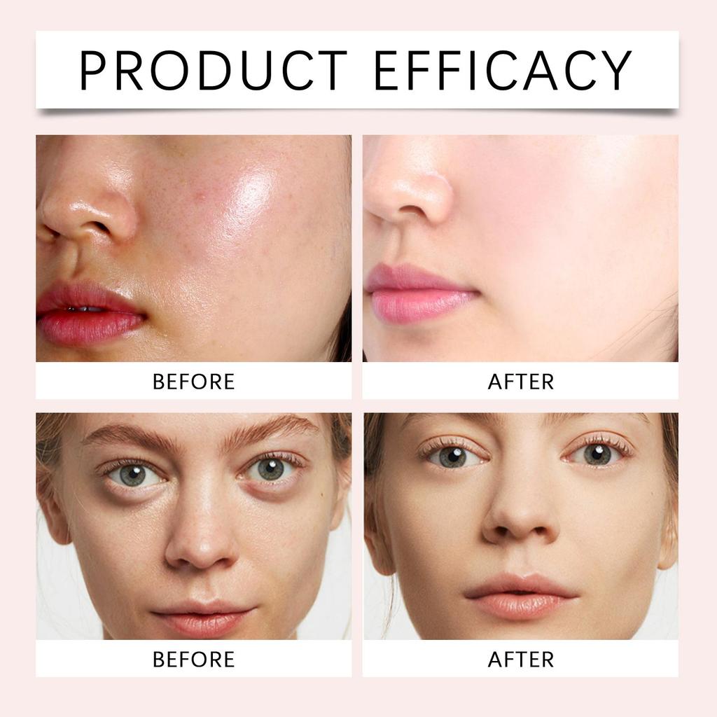 West Month Niacinamide Pore-Refining Serum Hydrates & Moisturizes Controls Oil Improves Skin Texture Minimizes Pores Soothes Skin For Face Use 30ml