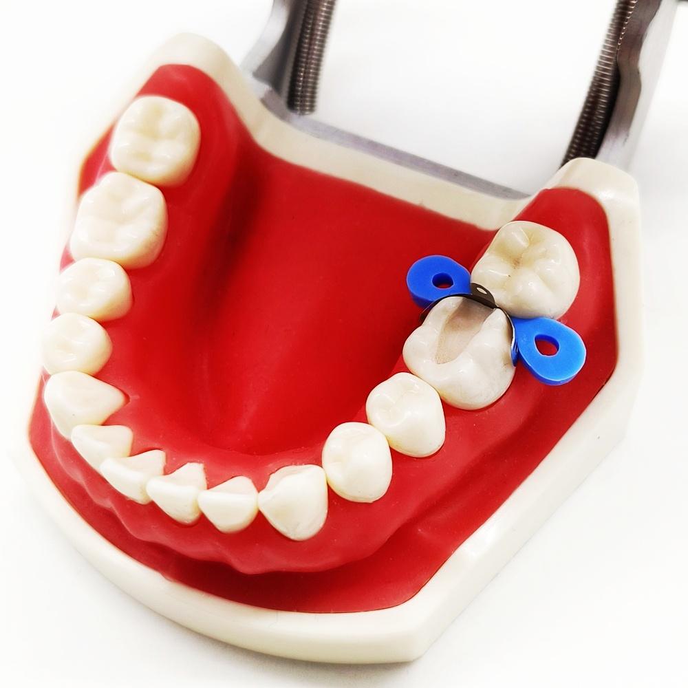 1 коробка, новые стоматологические 80 шт./упак., секционные контурные металлические матрицы, матрицы M4, набор матричных клиньев с дополнительными клиньями, резиновые клинья, полимерные зажимы