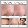 Face Soap, Natural Volcanic Mud Soap, Volcanic Mud Cleaning Soap, Black Soap Bar, Facical and Body Wash for Men Women
