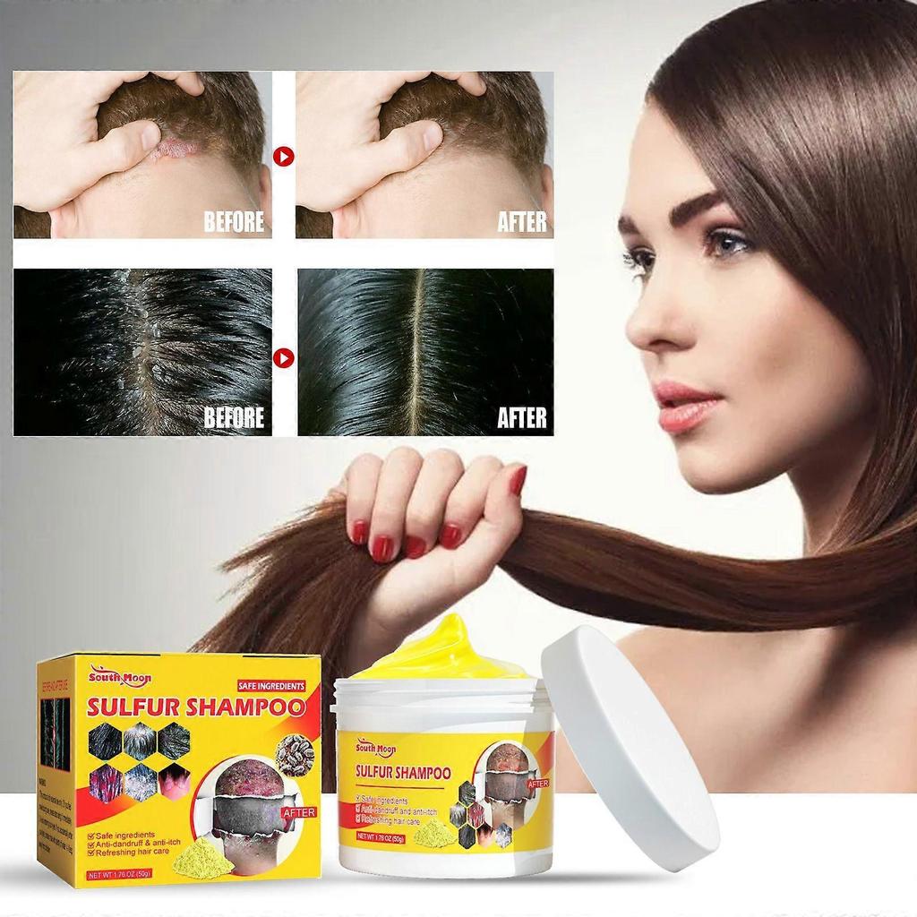 South Moon Sulfur Shampoo - Scalp Lice Removal, Cleans Hair Follicles, Relieves Itching, Controls Oil, Eliminates Mites And Bumps, Scalp Care less