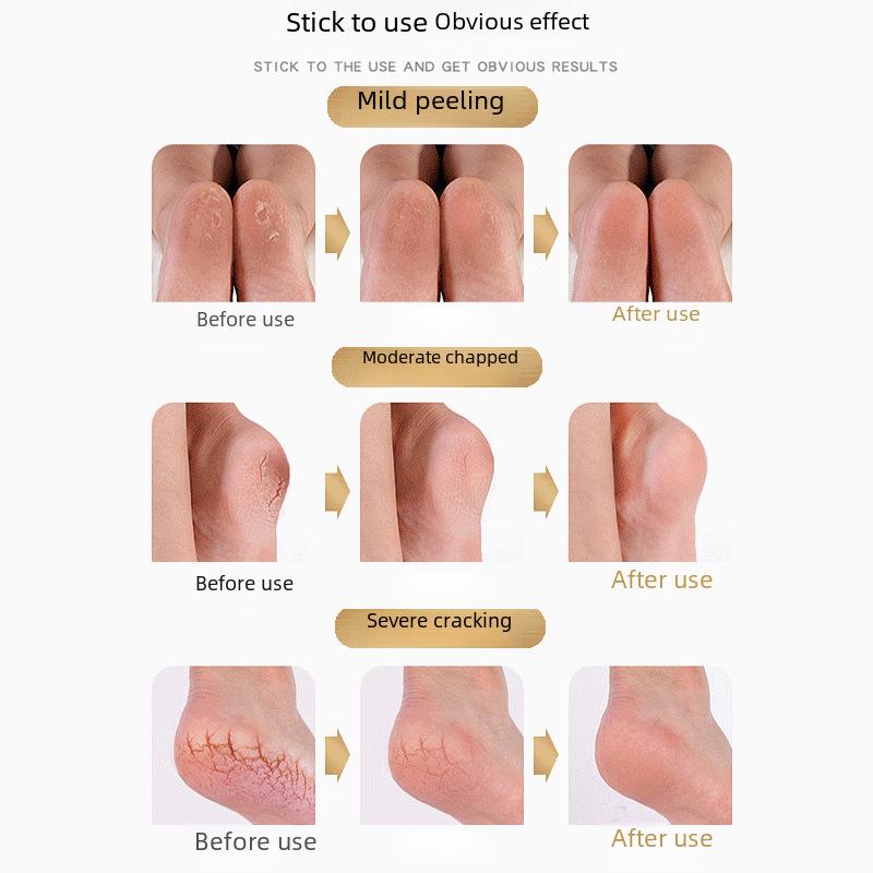 Silicone Anti-Crack Heel Socks for Men & Women - Protective Foot Cover To Prevent Heel Cracking