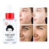 Skin Brightening Essence Liquid For Removing Chloasma Lightening Brightening Serum Kojic Acid Bleaching Cream Dropship